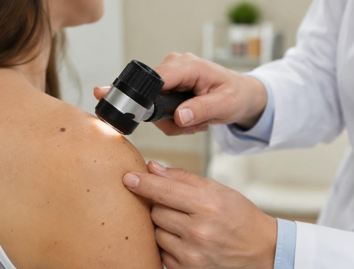 Kontrola znamének dermatoskopem